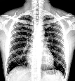 x-ray tube applications